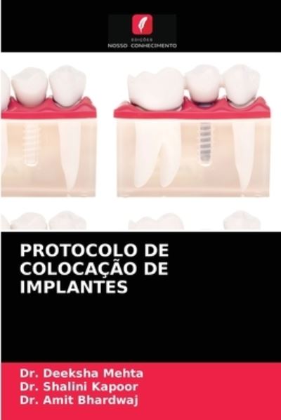 Cover for Dr Deeksha Mehta · Protocolo de Colocacao de Implantes (Paperback Book) (2021)