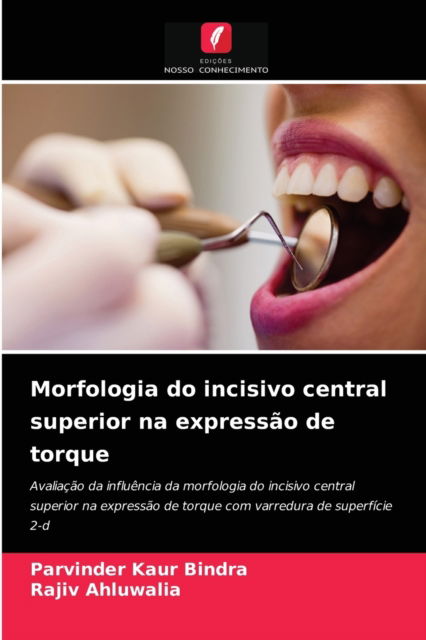 Morfologia do incisivo central superior na expressao de torque - Parvinder Kaur Bindra - Boeken - Edicoes Nosso Conhecimento - 9786204025483 - 26 augustus 2021