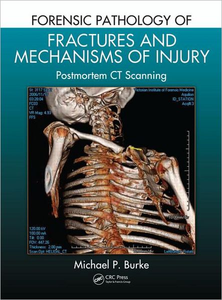 Cover for Michael P. Burke · Forensic Pathology of Fractures and Mechanisms of Injury: Postmortem CT Scanning (Hardcover Book) (2011)