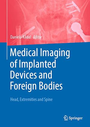Cover for Daniela Kildal · Medical Foreign Bodies in Imaging (Book) (2025)