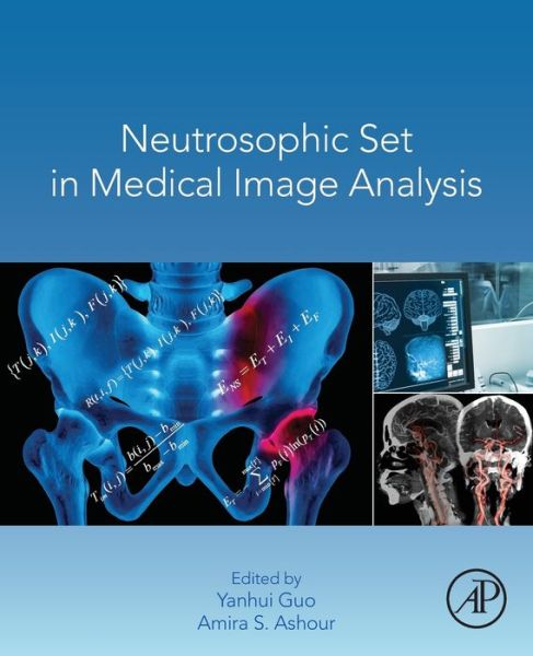 Cover for Yanhui Guo · Neutrosophic Set in Medical Image Analysis (Paperback Book) (2019)