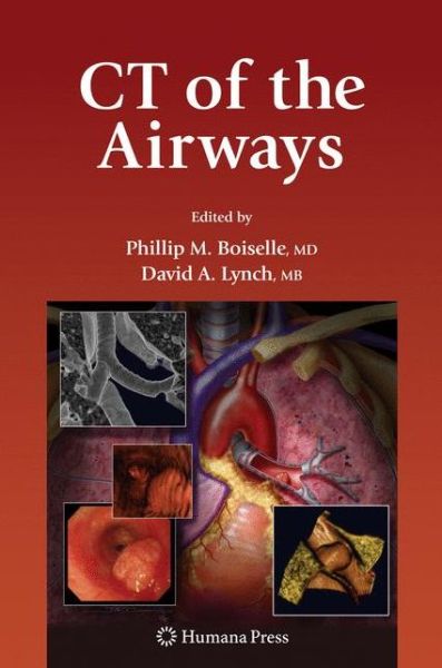 Cover for CT of the Airways - Contemporary Medical Imaging (Hardcover Book) [2008 edition] (2008)