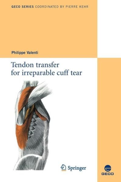 Cover for Philippe Valenti · Tendon transfer for irreparable cuff tear - Collection GECO (Pocketbok) (2010)
