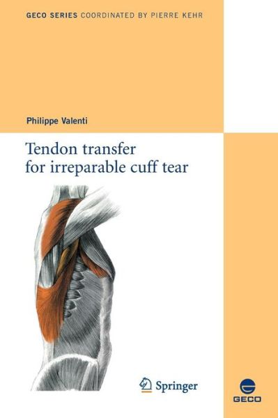 Tendon transfer for irreparable cuff tear - Collection GECO - Philippe Valenti - Books - Springer Editions - 9782817800486 - November 11, 2010