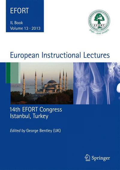 Cover for George Bentley · European Instructional Lectures: Volume 13, 2013, 14th EFORT Congress, Istanbul, Turkey - European Instructional Lectures (Hardcover Book) [2013 edition] (2013)