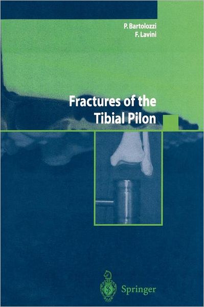 Fractures of the Tibial Pilon - P. Bartolozzi - Books - Springer Verlag - 9788847002487 - August 9, 2004