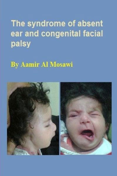 Cover for Aamir Jalal Al Mosawi · The Syndrome of Absent Ear and Congenital Facial Palsy (Paperback Bog) (2018)