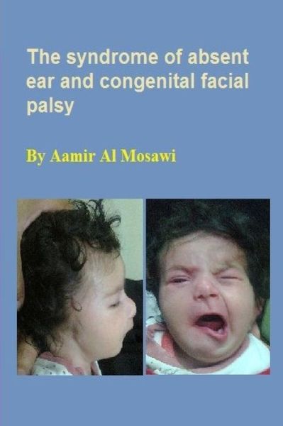 Cover for Aamir Jalal Al Mosawi · The Syndrome of Absent Ear and Congenital Facial Palsy (Paperback Book) (2018)