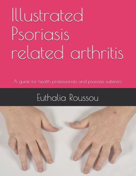 Cover for Euthalia Roussou · Illustrated Psoriasis related arthritis (Paperback Bog) (2019)