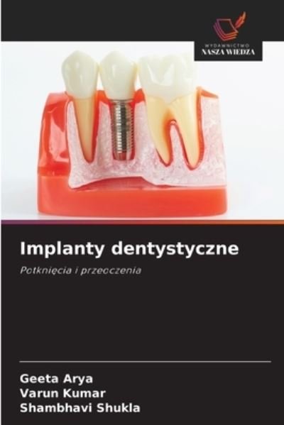 Cover for Geeta Arya · Implanty dentystyczne (Pocketbok) (2020)