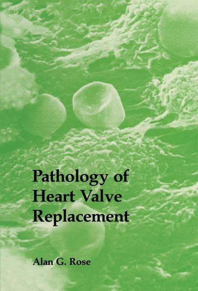 A.G. Rose · Pathology of Heart Valve Replacement (Paperback Book) [Softcover reprint of the original 1st ed. 1987 edition] (2011)