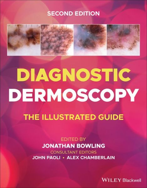 Diagnostic Dermoscopy: The Illustrated Guide - J Bowling - Livros - John Wiley and Sons Ltd - 9781118930489 - 9 de junho de 2022