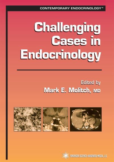 Challenging Cases in Endocrinology - Contemporary Endocrinology - Mark E Molitch - Books - Humana Press Inc. - 9781617372490 - November 9, 2010