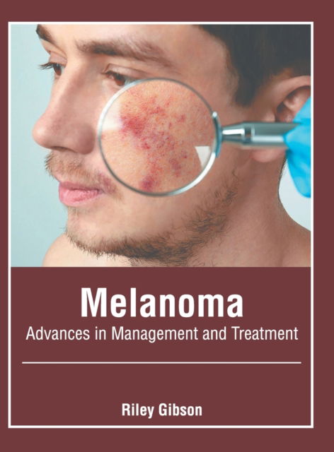 Cover for Riley Gibson · Melanoma: Advances in Management and Treatment (Hardcover Book) (2020)