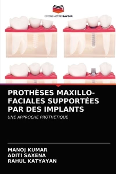 Cover for Kumar · Prothèses Maxillo-faciales Suppor (N/A) (2021)