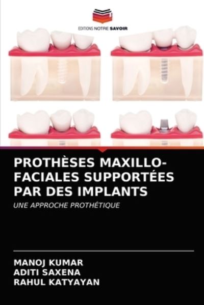 Prothèses Maxillo-faciales Suppor - Kumar - Outro - - 9786203402490 - 10 de março de 2021