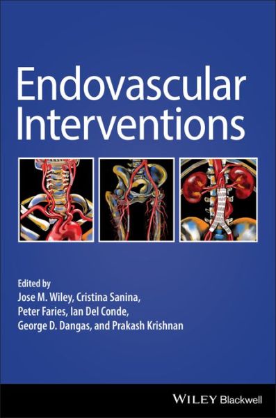 Cover for J Wiley · Endovascular Interventions (Hardcover Book) (2019)