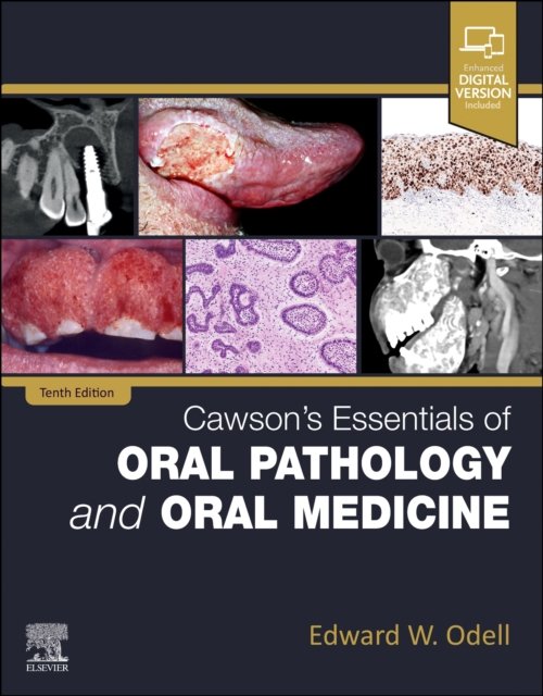 Cover for Odell, Edward W, FDSRCS, MSc, PhD, FRCPath (Professor of Oral Pathology and Medicine, King's College London; Honorary Consultant in Oral Pathology, Guy's and St Thomas' NHS Foundation Trust, London) · Cawson's Essentials of Oral Pathology and Oral Medicine (Paperback Book) (2024)