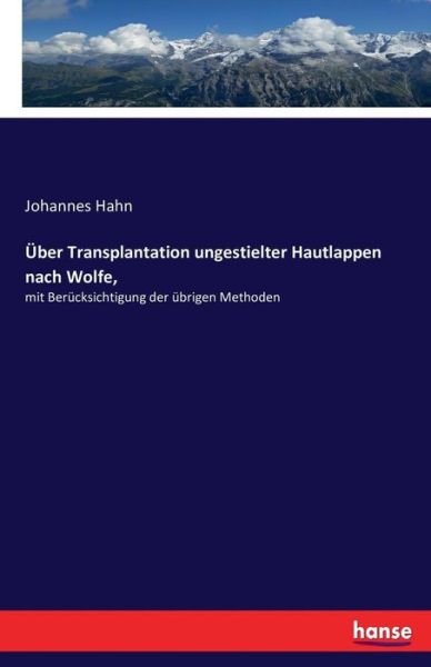 Cover for Hahn · Über Transplantation ungestielter (Bok) (2016)