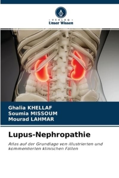 Cover for Ghalia Khellaf · Lupus-Nephropathie (Pocketbok) (2021)