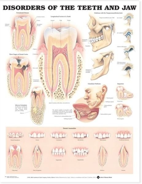 Cover for Acc 9866pl1.5 · Disorders of the Teeth and Jaw Anatomical Chart (Map) (2000)