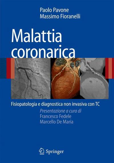 Cover for Paolo Pavone · Malattia coronarica: Fisiopatologia e diagnostica non invasiva con TC (Paperback Book) (2008)