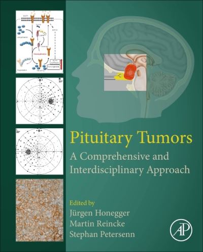 Cover for Pituitary Tumors: A Comprehensive and Interdisciplinary Approach (Hardcover Book) (2021)