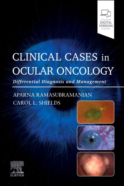 Clinical Cases in Ocular Oncology: Differential Diagnosis and Management - - Books - Elsevier Health Sciences - 9780443120497 - November 5, 2024