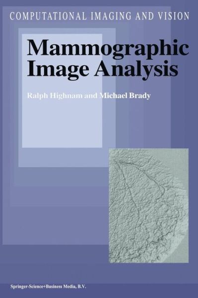 R. Highnam · Mammographic Image Analysis - Computational Imaging and Vision (Paperback Book) [Softcover reprint of the original 1st ed. 1999 edition] (2012)