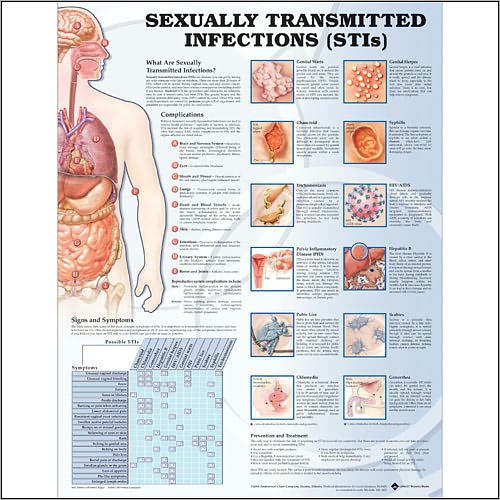 Cover for Anatomical Chart Com · Sexually Transmitted Infections Anatomical Chart (Map) (2004)