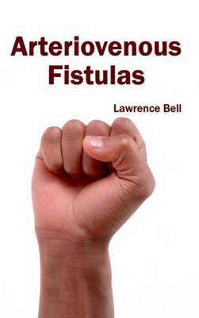 Cover for Lawrence Bell · Arteriovenous Fistulas (Gebundenes Buch) (2015)