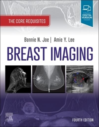 Cover for Joe, Bonnie N. (Professor, Radiology&lt;br&gt;Chief, Breast Imaging&lt;br&gt;Department of Radiology and Biomedical Imaging&lt;br&gt;University of California - San Francisco&lt;br&gt;San Francisco, CA) · Breast Imaging: The Core Requisites - The Core Requisites (Taschenbuch) (2022)