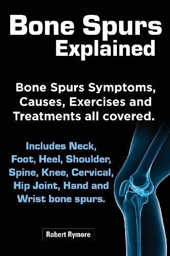 Cover for Robert Rymore · Bone Spurs Explained. Bone Spurs Symptoms, Causes, Exercises and Treatments All Covered. Includes Neck, Foot, Heel, Shoulder, Spine, Knee, Cervical, H (Paperback Book) (2013)