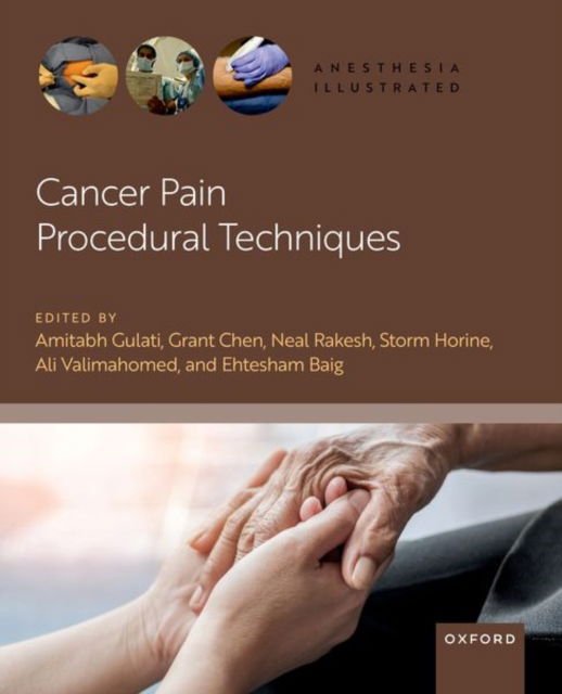 Gulati · Cancer Pain Procedural Techniques - Anesthesia Illustrated (Taschenbuch) (2024)