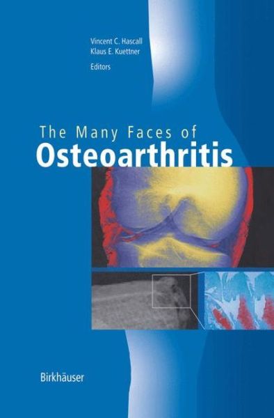 Cover for Vincent C Hascall · The Many Faces of Osteoarthritis (Paperback Book) [Softcover reprint of the original 1st ed. 2002 edition] (2012)