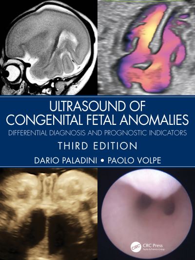 Cover for Paladini, Dario (Gaslini Children’s Hospital, Genoa, Italy) · Ultrasound of Congenital Fetal Anomalies: Differential Diagnosis and Prognostic Indicators (Hardcover Book) (2024)