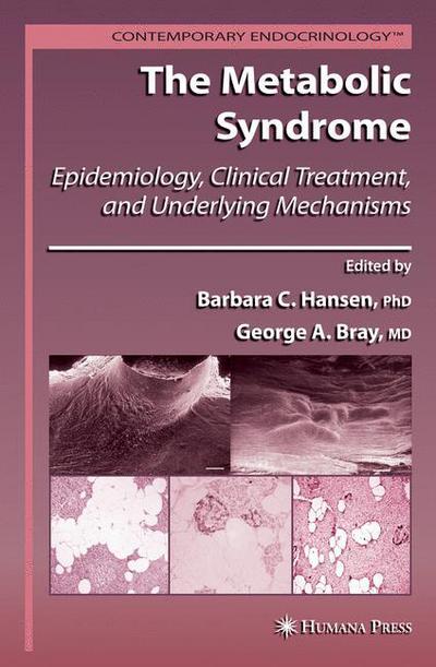 Cover for Barbara C Hansen · The Metabolic Syndrome:: Epidemiology, Clinical Treatment, and Underlying Mechanisms - Contemporary Endocrinology (Paperback Book) [Softcover reprint of hardcover 1st ed. 2008 edition] (2010)