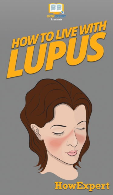 Cover for Howexpert · How To Live With Lupus (Hardcover Book) (2020)