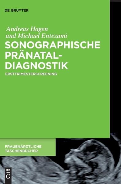 Cover for Hagen · Sonographische Pränataldiagnostik (Book) (2018)