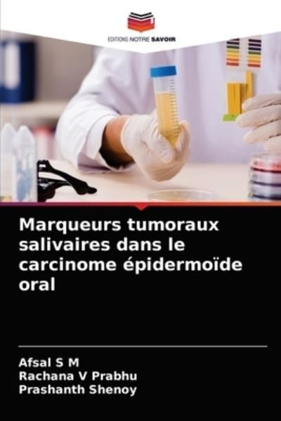 Cover for Afsal S M · Marqueurs tumoraux salivaires dans le carcinome epidermoide oral (Taschenbuch) (2021)