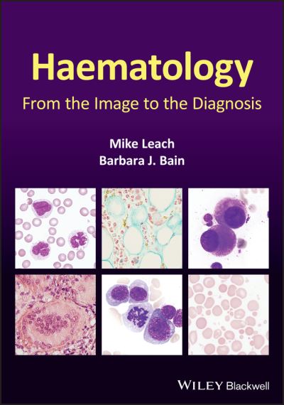 Cover for Leach, Mike (Gartnavel General Hospital, Glasgow, UK) · Haematology: From the Image to the Diagnosis (Hardcover bog) (2021)