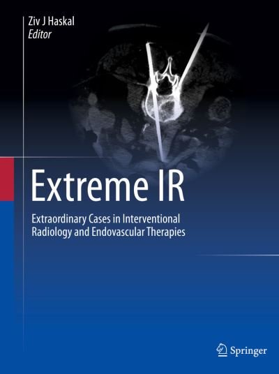 Cover for Ziv J. Haskal · Extreme IR: Extraordinary Cases in Interventional Radiology and Endovascular Therapies (Hardcover Book) [1st ed. 2023 edition] (2023)
