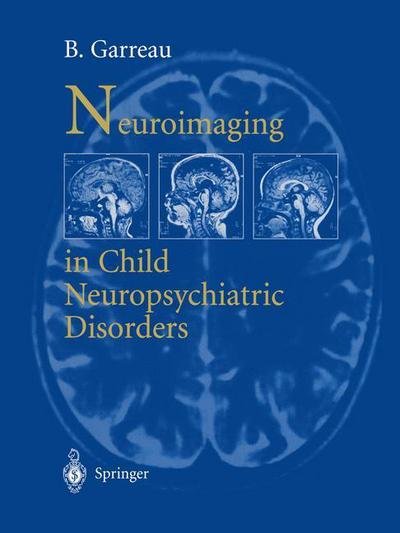 Cover for B Garreau · Neuroimaging in child neuropsychiatric disorders (Paperback Book) [Softcover reprint of the original 1st ed. 1998 edition] (2012)