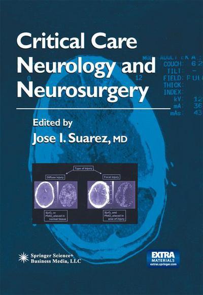 Cover for Jose I Suarez · Critical Care Neurology and Neurosurgery - Current Clinical Neurology (Paperback Book) [Softcover reprint of hardcover 1st ed. 2004 edition] (2010)