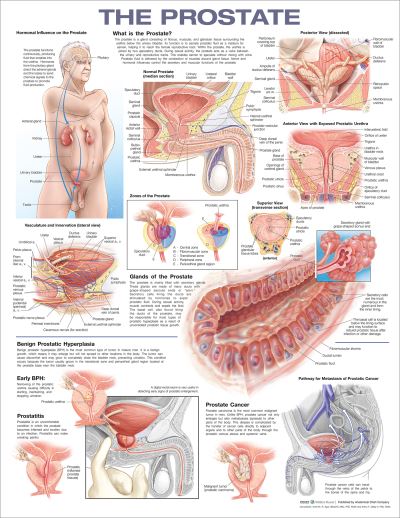 Cover for Acc · Prostate 2E Laminated Chart (MERCH)