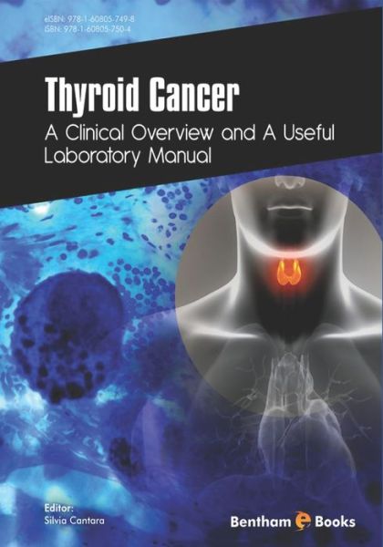 Cover for Silvia Cantara · Thyroid Cancer (Paperback Book) (2018)