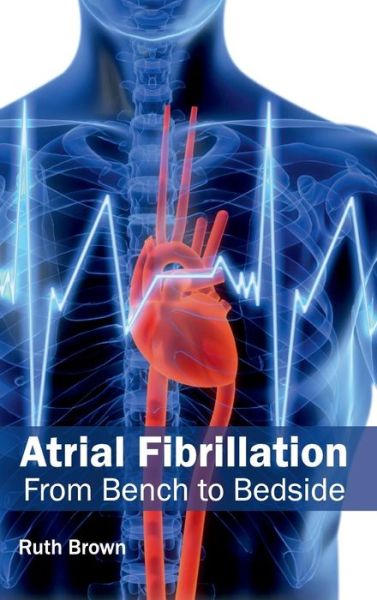 Atrial Fibrillation: from Bench to Bedside - Ruth Brown - Kirjat - Hayle Medical - 9781632410504 - lauantai 17. tammikuuta 2015