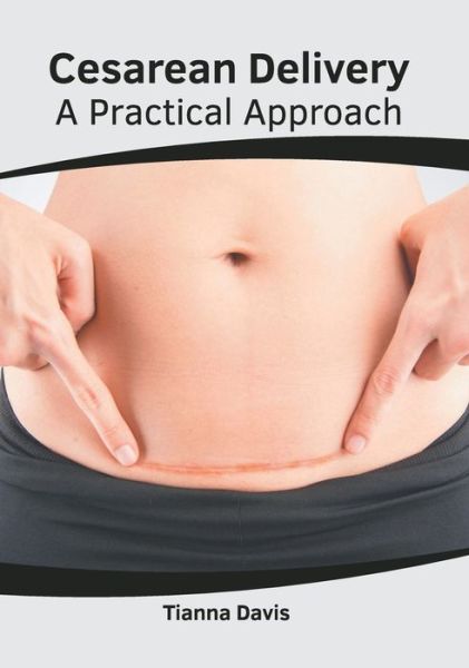 Cover for Tianna Davis · Cesarean Delivery: A Practical Approach (Hardcover Book) (2022)