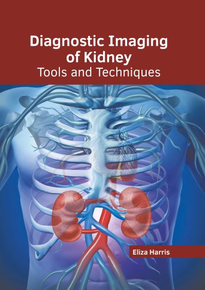 Cover for Eliza Harris · Diagnostic Imaging of Kidney: Tools and Techniques (Hardcover Book) (2022)