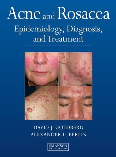Cover for David Goldberg · Acne and Rosacea: Epidemiology, Diagnosis and Treatment (Inbunden Bok) (2011)